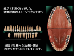 ISIシステム